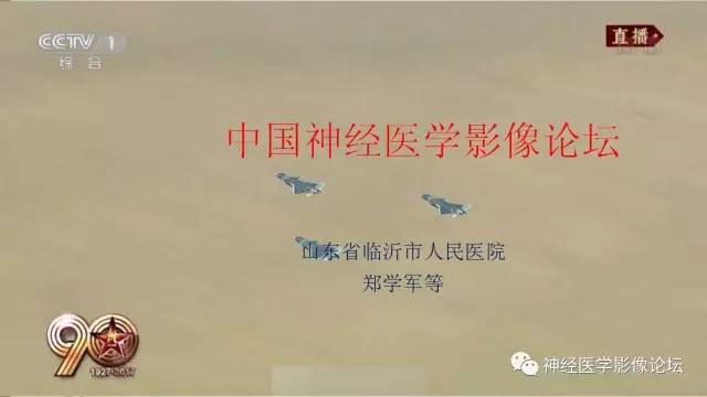 【病例】囊性脑膜瘤2例CT及MR