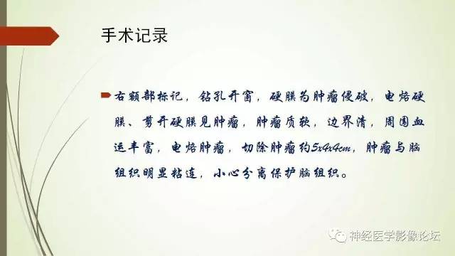 【病例】囊性脑膜瘤2例CT及MR