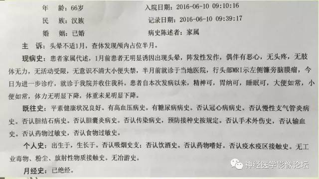 【病例】囊性脑膜瘤2例CT及MR