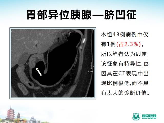 【PPT】胃部少见原发肿瘤的CT诊断