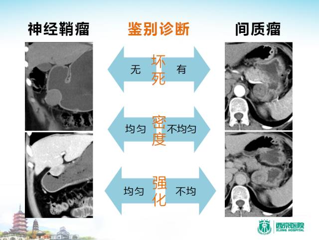 【PPT】胃部少见原发肿瘤的CT诊断