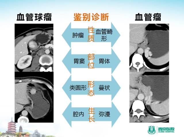 【PPT】胃部少见原发肿瘤的CT诊断