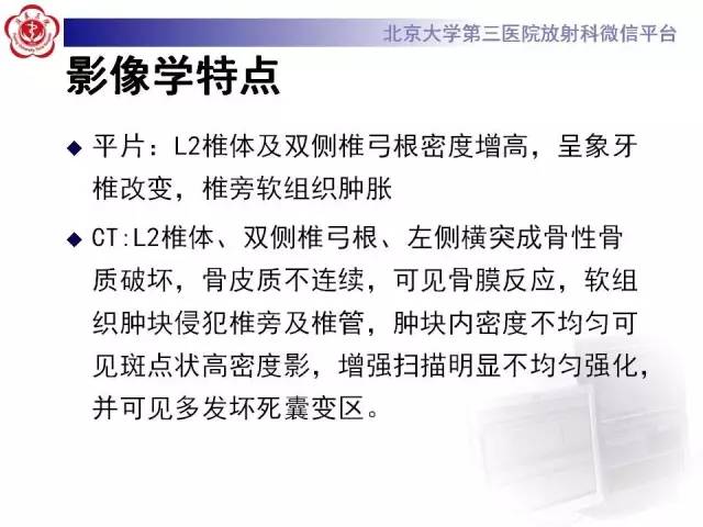 【病例】腰椎尤文肉瘤1例X线CT及MR