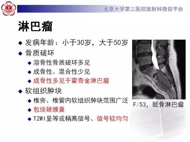 【病例】腰椎尤文肉瘤1例X线CT及MR