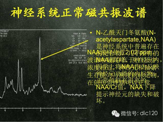 【PPT】脑磁共振波谱MRS