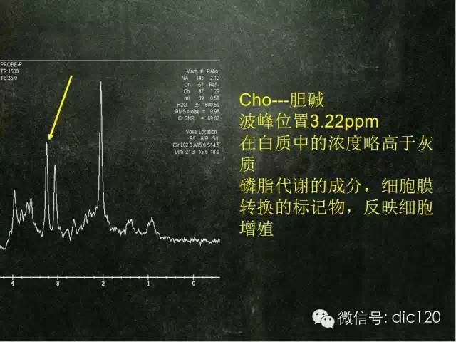 【PPT】脑磁共振波谱MRS