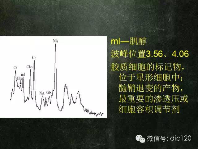【PPT】脑磁共振波谱MRS