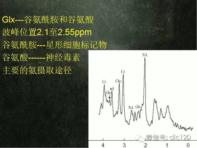 【PPT】脑磁共振波谱MRS