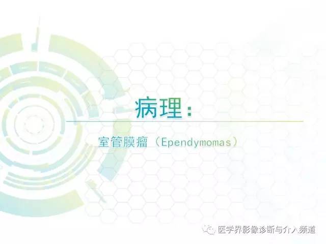 【病例】腰椎椎管内室管膜瘤1例MR