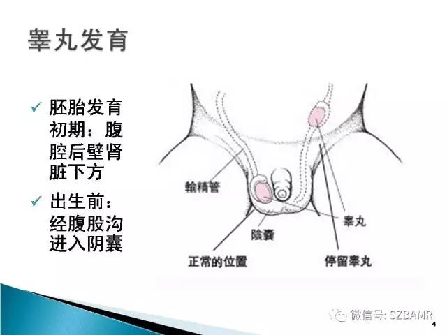 【PPT】睾丸肿瘤病变MR诊断