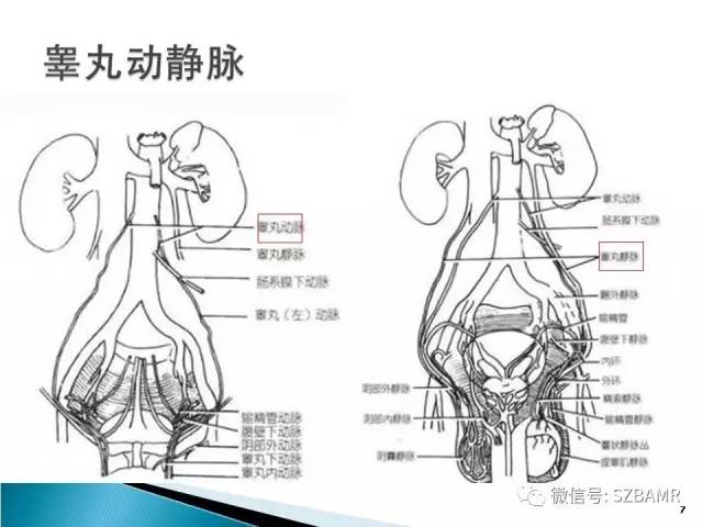 【PPT】睾丸肿瘤病变MR诊断