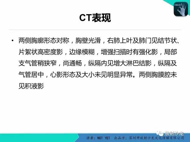 【病例】原发性肺结核1例CT影像表现 【病例】原发性肺结核1例CT影像表现