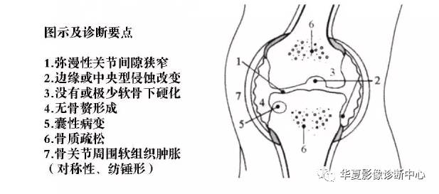 膝关节炎有五类,您能分清了么? 膝关节炎有五类,您能分清了么?