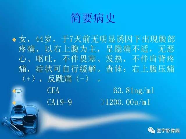 【病例】胰腺囊腺癌1例CT影像表现