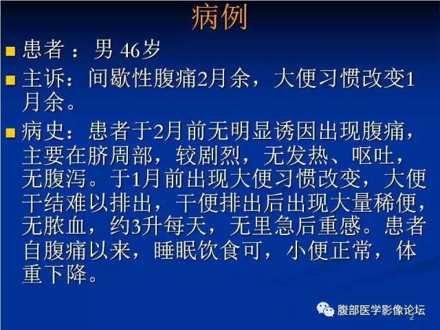 【病例】回肠淋巴瘤并肠套叠1例CT影像表现