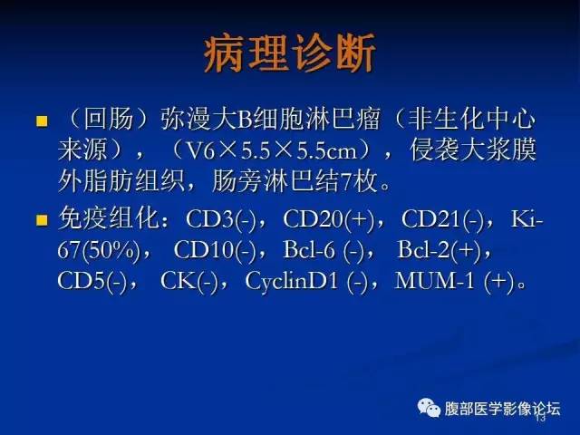 【病例】回肠淋巴瘤并肠套叠1例CT影像表现 【病例】回肠淋巴瘤并肠套叠1例CT影像表现