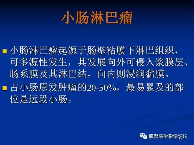 【病例】回肠淋巴瘤并肠套叠1例CT影像表现 【病例】回肠淋巴瘤并肠套叠1例CT影像表现