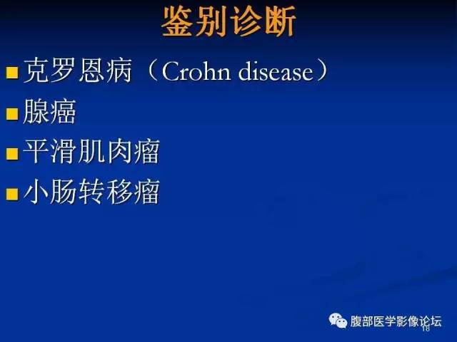 【病例】回肠淋巴瘤并肠套叠1例CT影像表现 【病例】回肠淋巴瘤并肠套叠1例CT影像表现