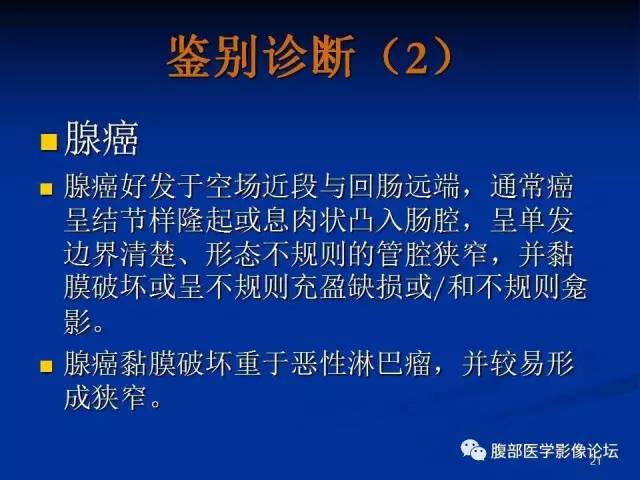 【病例】回肠淋巴瘤并肠套叠1例CT影像表现 【病例】回肠淋巴瘤并肠套叠1例CT影像表现