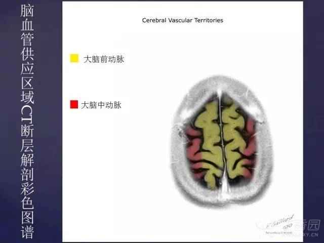 【PPT】脑血管支配区域CT彩色图谱