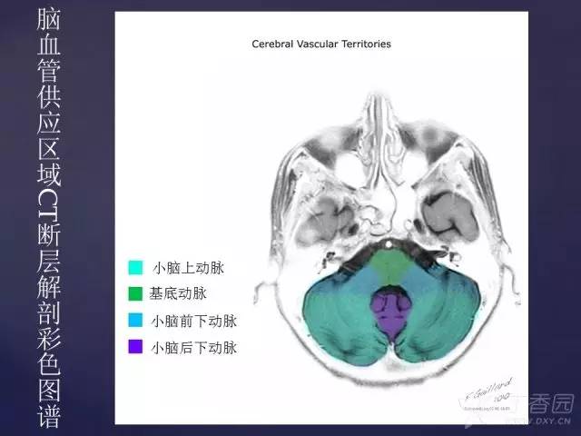 【PPT】脑血管支配区域CT彩色图谱