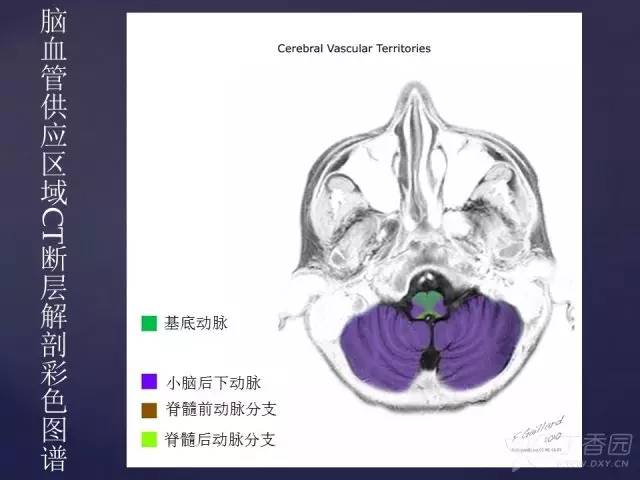 【PPT】脑血管支配区域CT彩色图谱