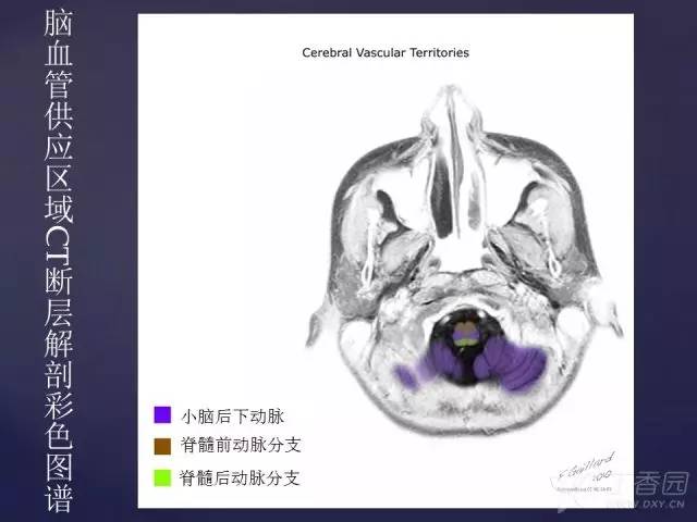 【PPT】脑血管支配区域CT彩色图谱
