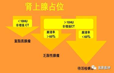 肾上腺良恶性病变的影像学鉴别诊断 肾上腺良恶性病变的影像学鉴别诊断