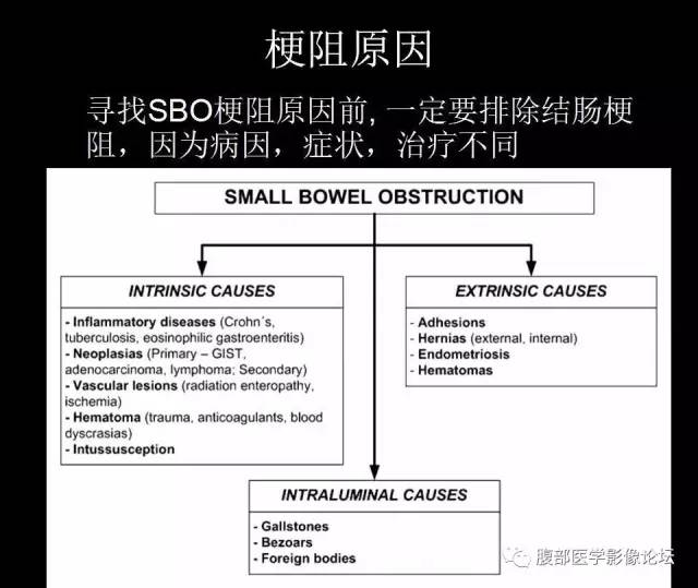 【PPT】小肠梗阻看什么？