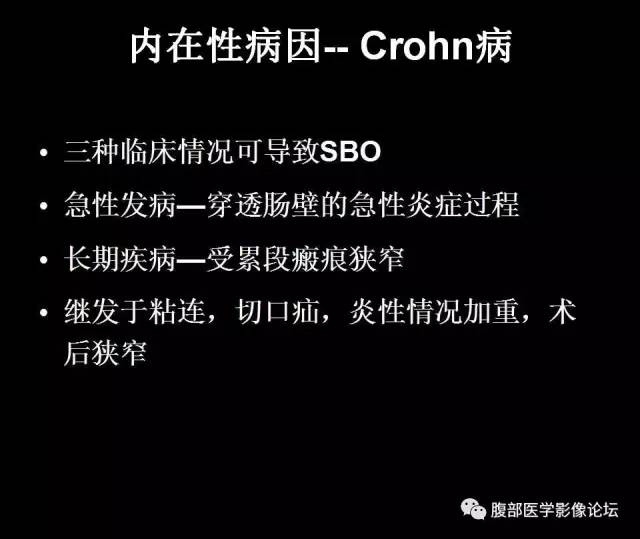 【PPT】小肠梗阻看什么？
