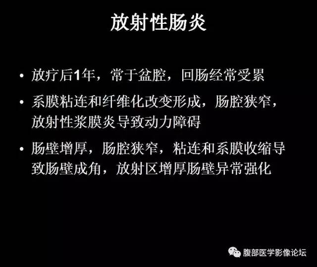 【PPT】小肠梗阻看什么？