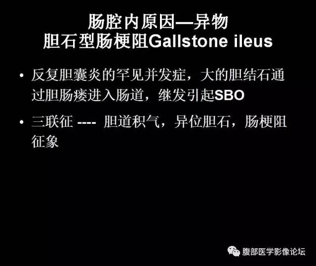 【PPT】小肠梗阻看什么？