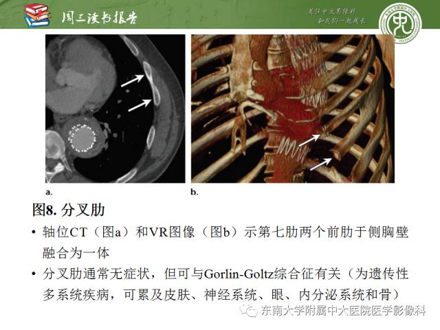 【PPT】创伤性肋骨损伤：类型、影像不足、并发症和治疗【RG精选】