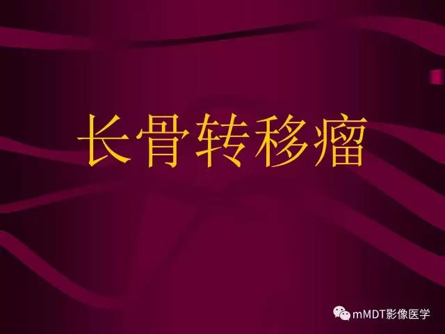 【PPT】骨转移瘤的少见表现