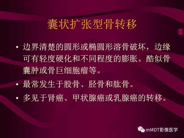 【PPT】骨转移瘤的少见表现