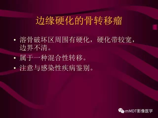 【PPT】骨转移瘤的少见表现