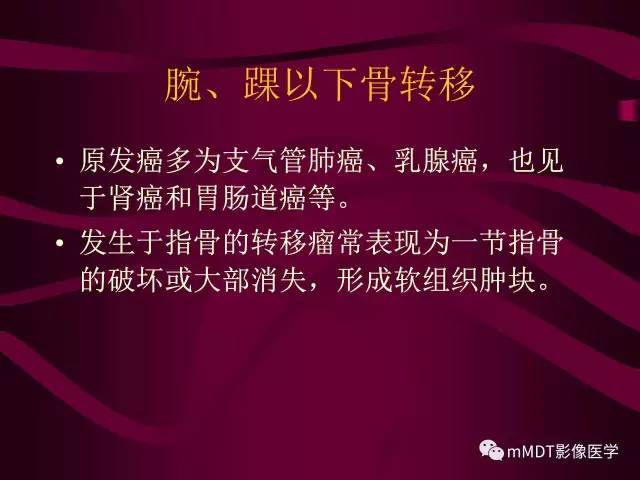 【PPT】骨转移瘤的少见表现