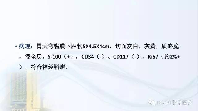 【PPT】胃神经鞘瘤