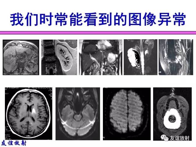 【PPT】MRI伪影与对策