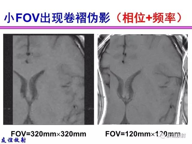 【PPT】MRI伪影与对策