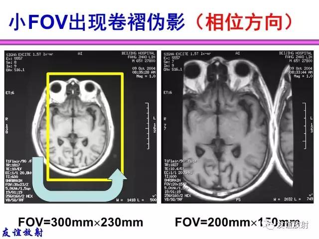 【PPT】MRI伪影与对策