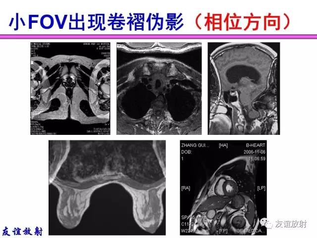 【PPT】MRI伪影与对策