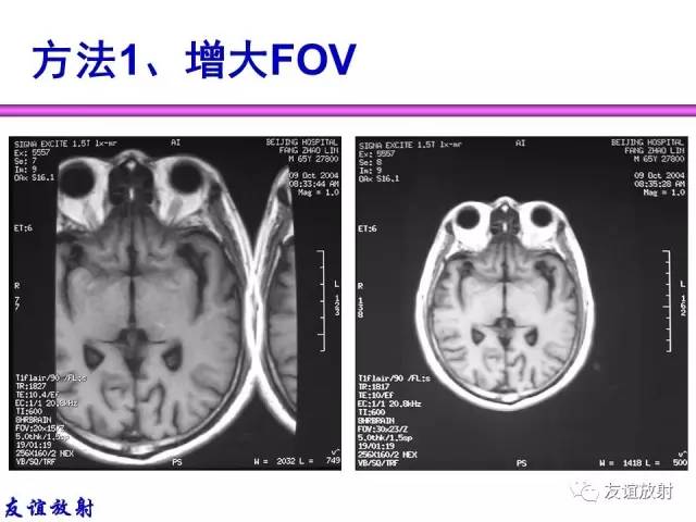 【PPT】MRI伪影与对策