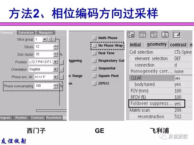 【PPT】MRI伪影与对策