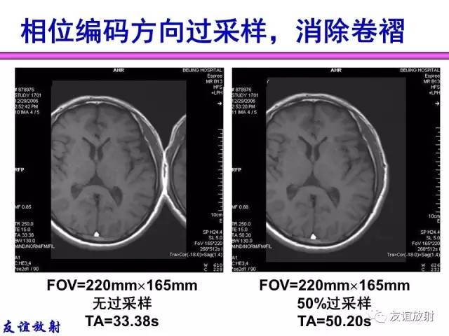 【PPT】MRI伪影与对策