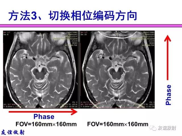 【PPT】MRI伪影与对策