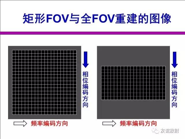 【PPT】MRI伪影与对策