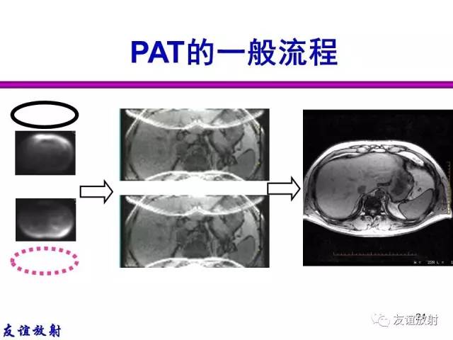 【PPT】MRI伪影与对策