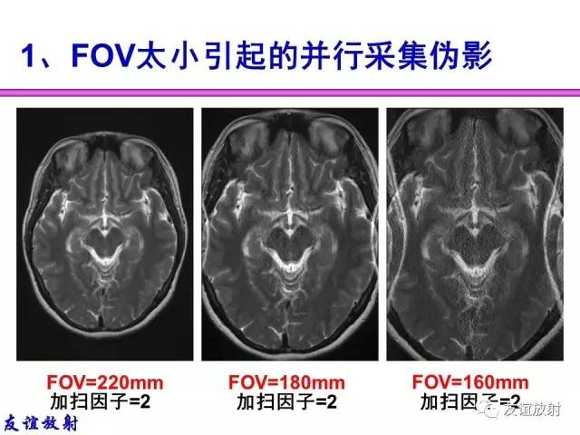 【PPT】MRI伪影与对策