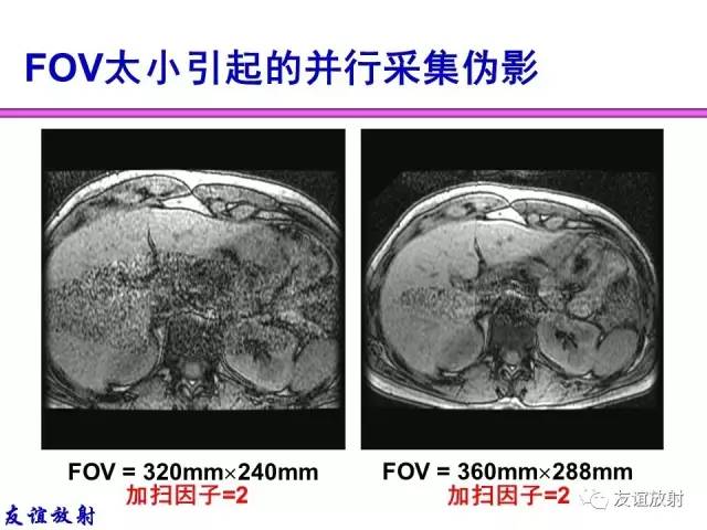 【PPT】MRI伪影与对策